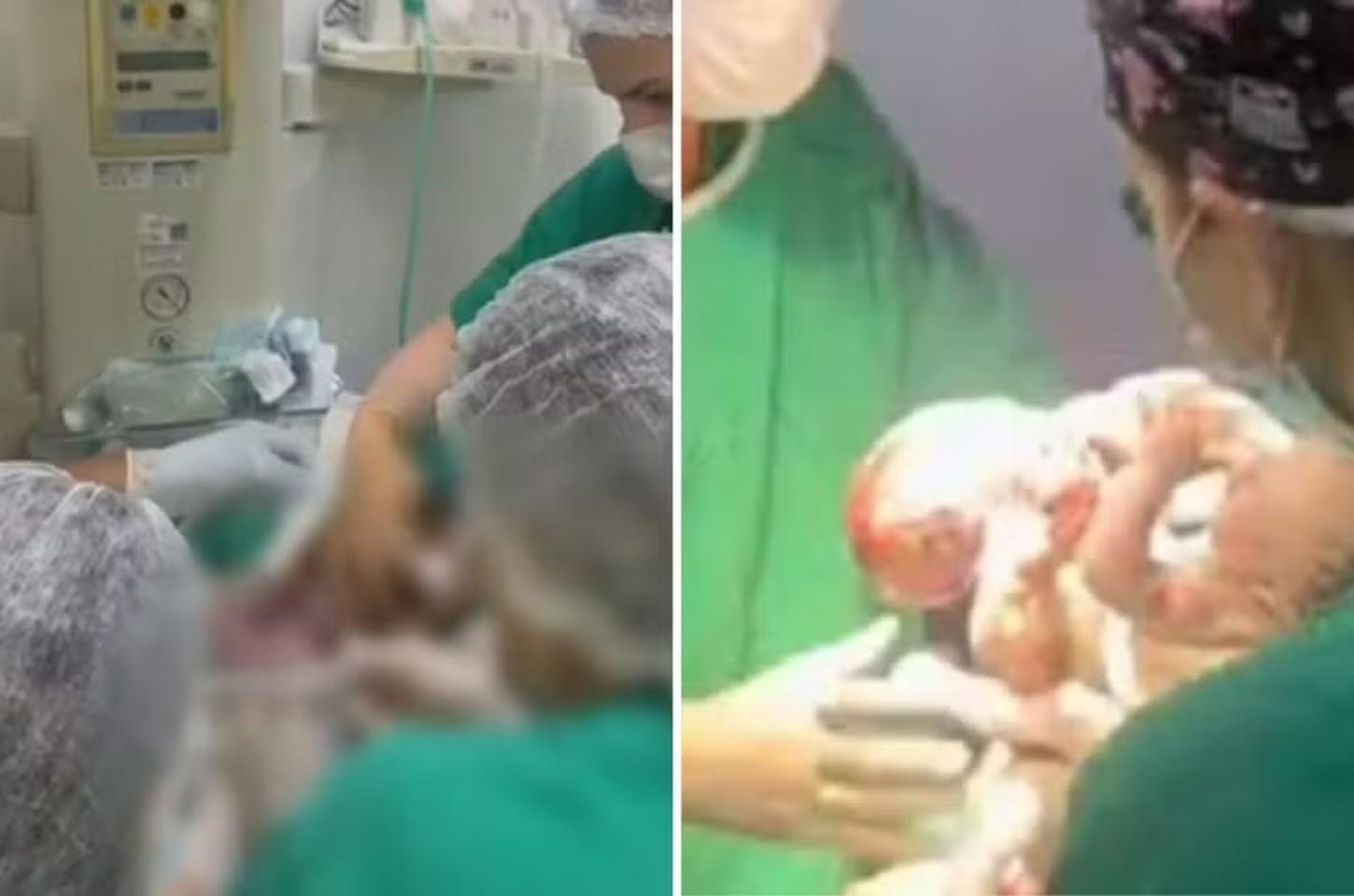 Da descoberta da gestação ao parto: saiba como mãe de MT descobriu que esperava gêmeos siameses