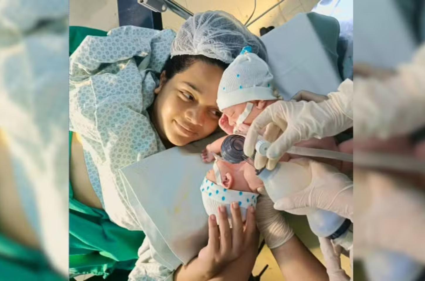 Morre o segundo gêmeo siamês de MT que nasceu em Goiânia