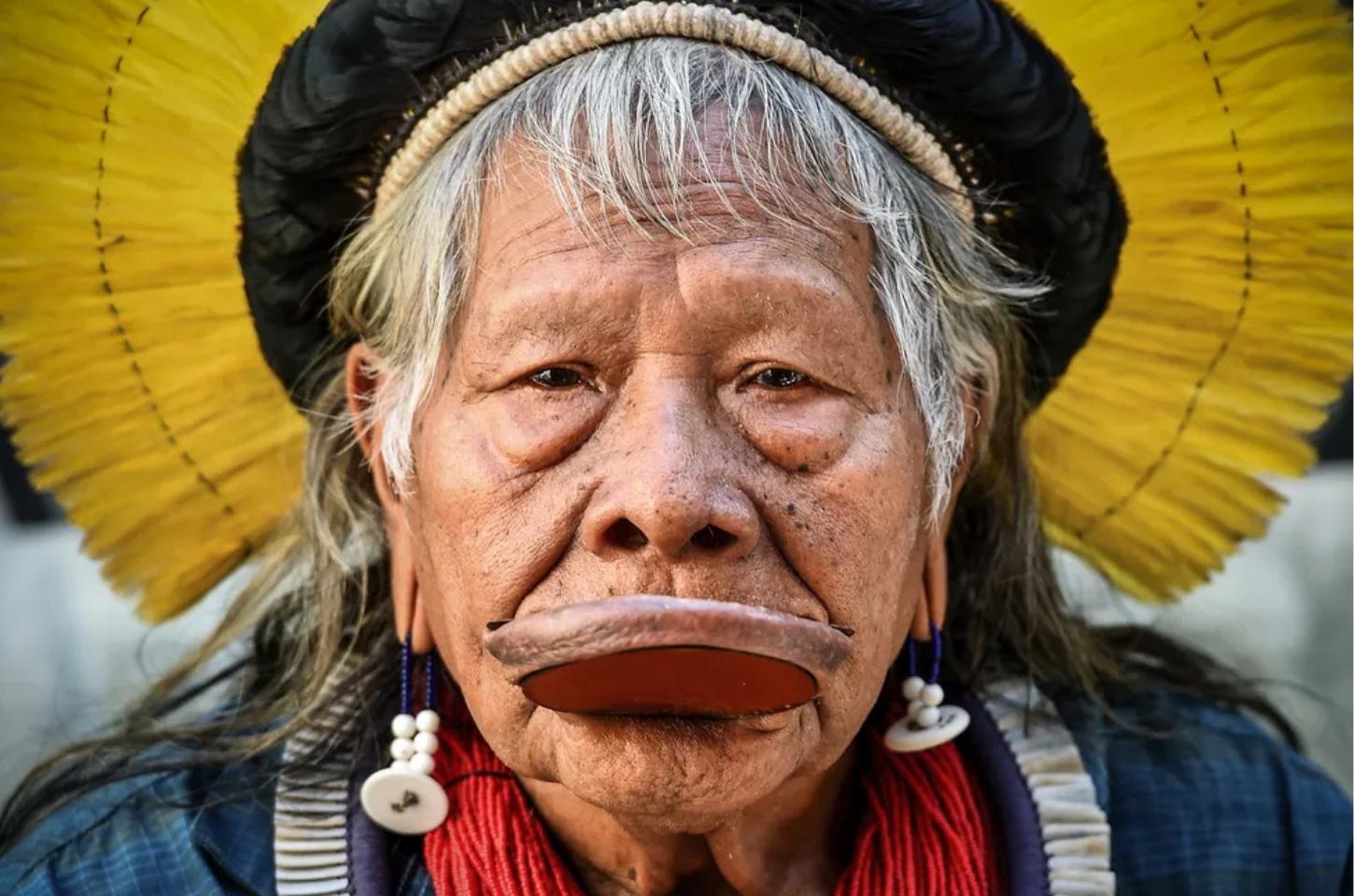 Cacique Raoni apresenta evolução clínica, mas permanece internado em UTI de MT